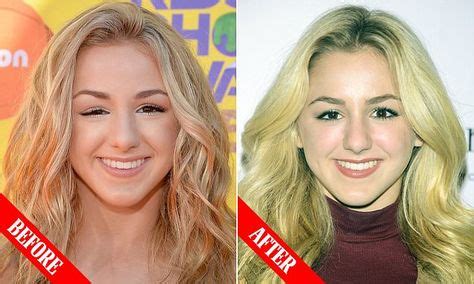 what medical condition did chloe have on dance moms|chloe lukasiak medical condition.